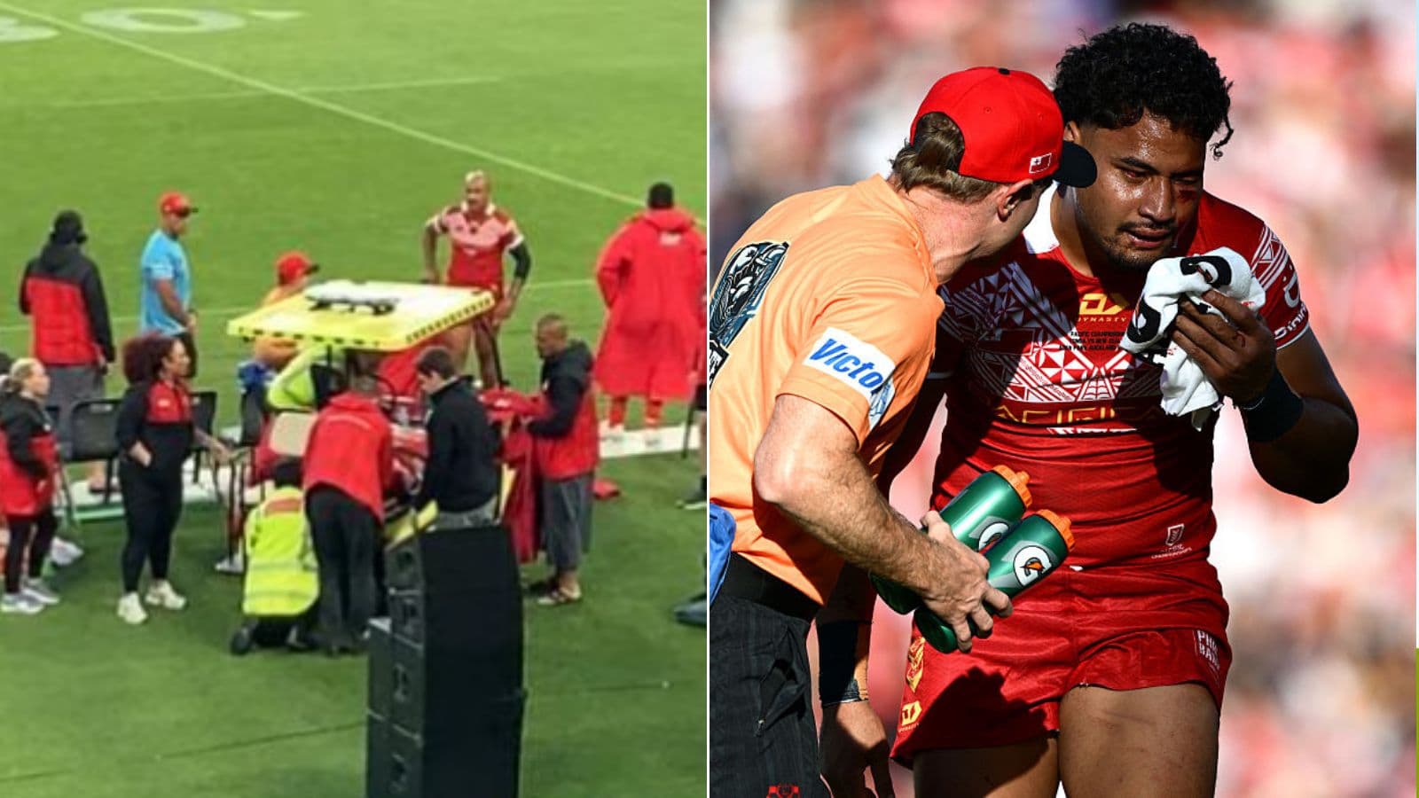 'It's heart-breaking': Storm give update on Katoa after brain surgery