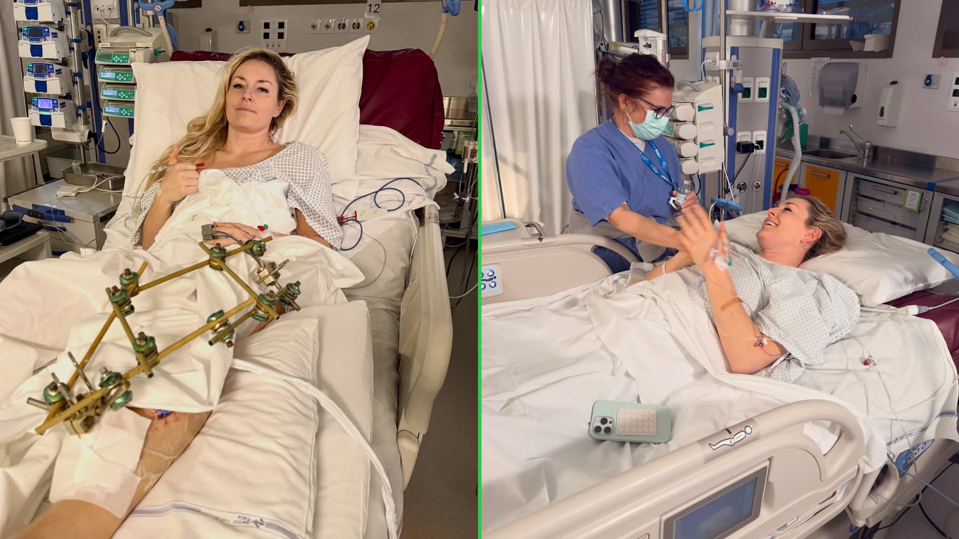 Vonn has 'successful' third surgery on broken leg