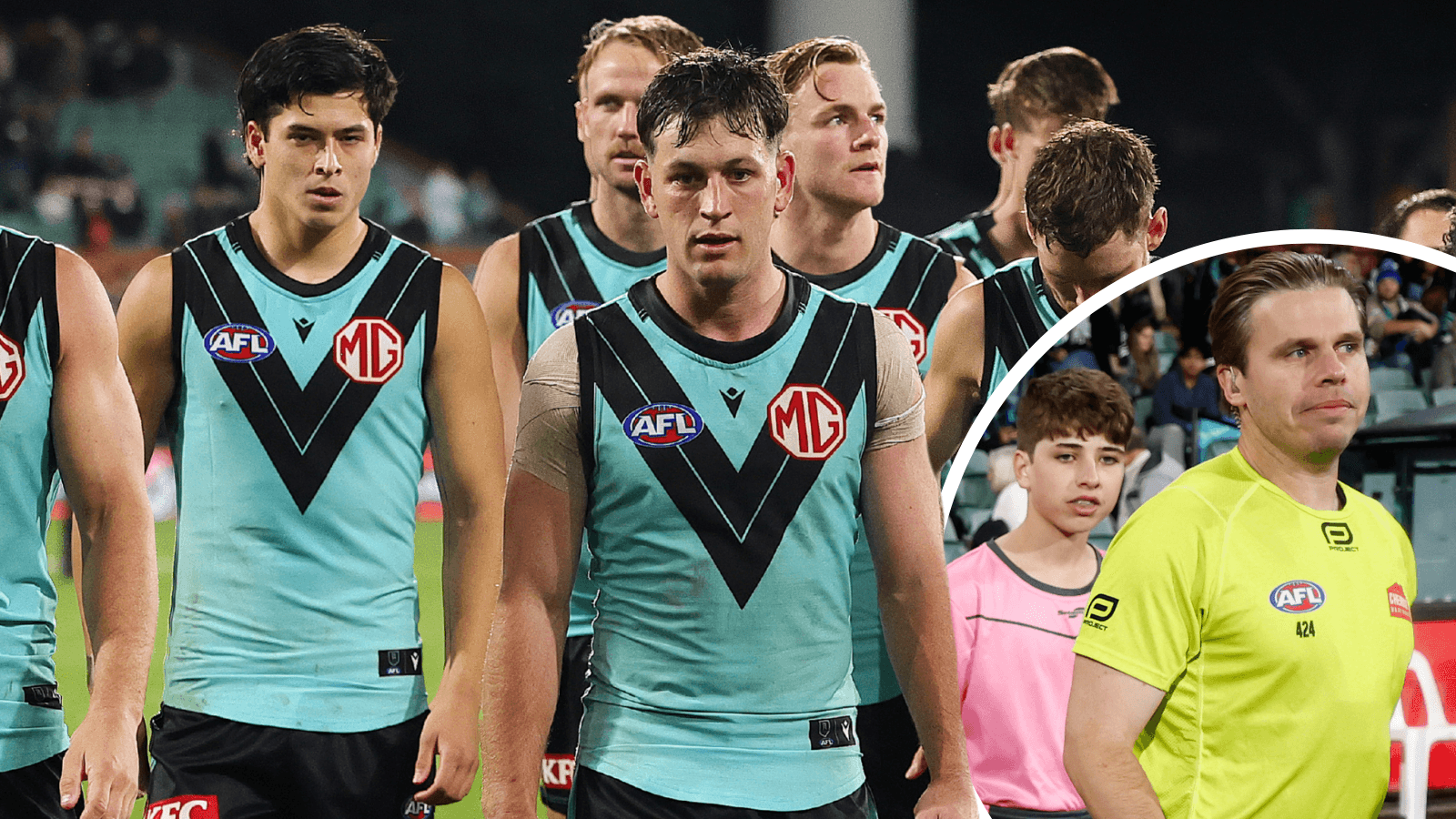 Diffuse the situation: Watson’s take on Butters-Foot incident