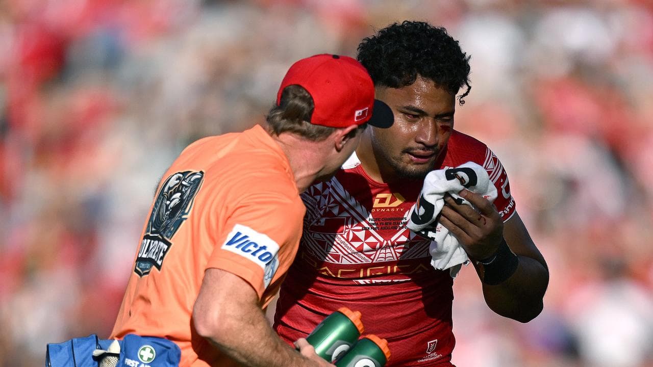 Katoa stable, but NRL to investigate Tonga star's head knocks