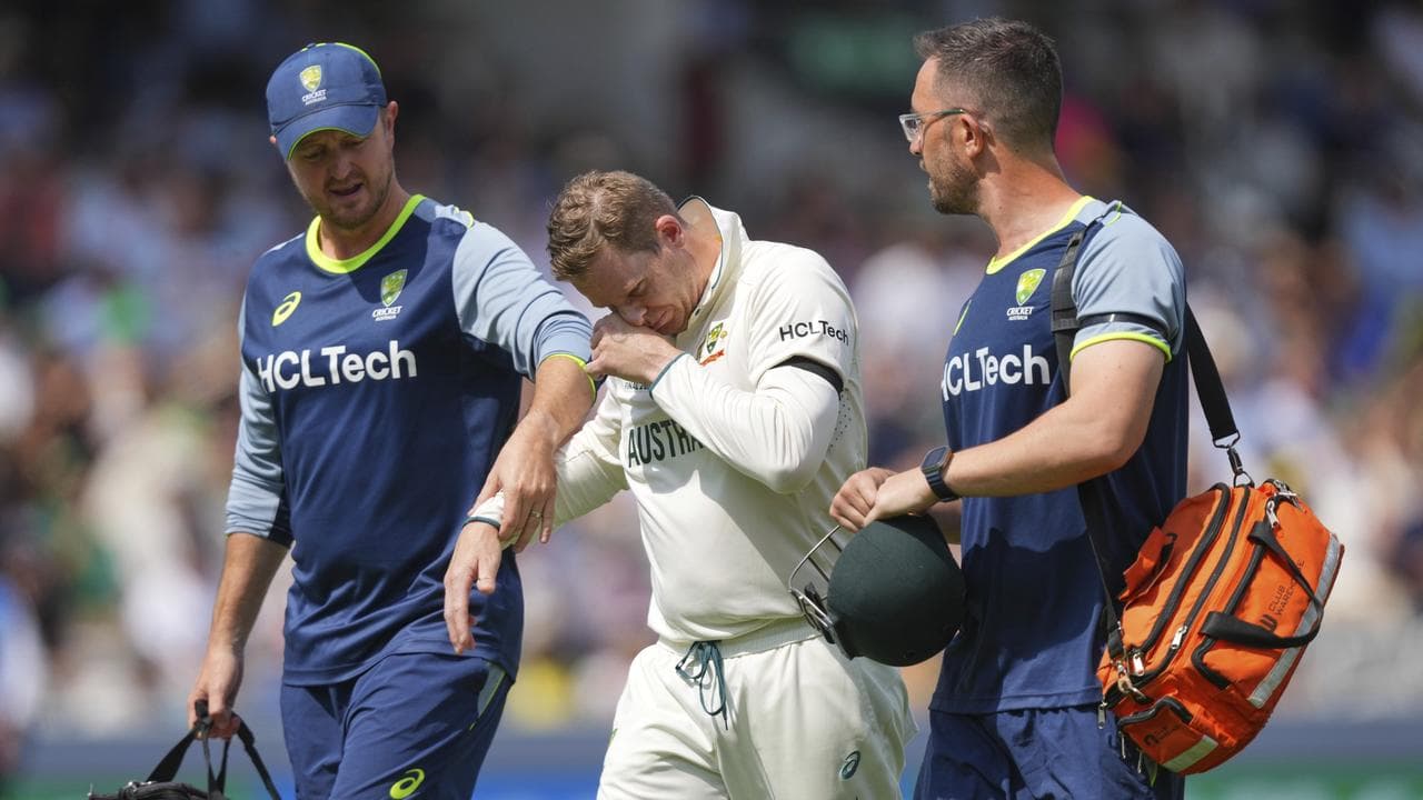 The 'good result' from Steve Smith's finger dislocation
